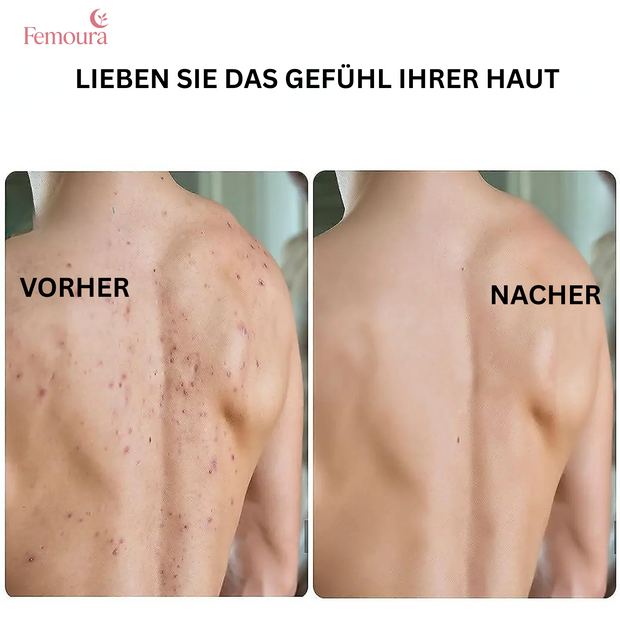 Femoura Peeling-Handschuh®